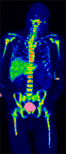 pet radiology